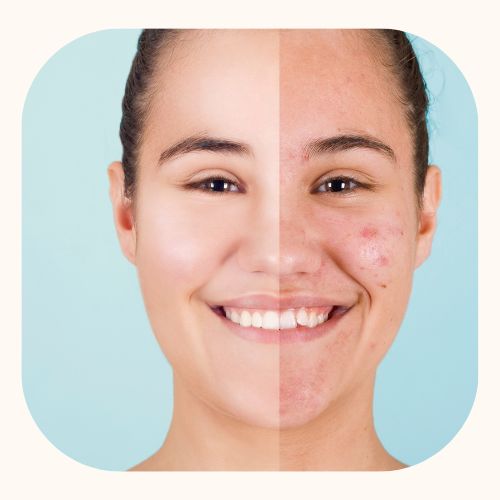 Flacon d’huile de nigelle 100 % naturelle – 100 ml – pressée à froid